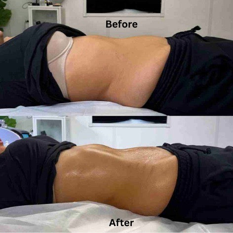 Lymphatic Vitality Drops™